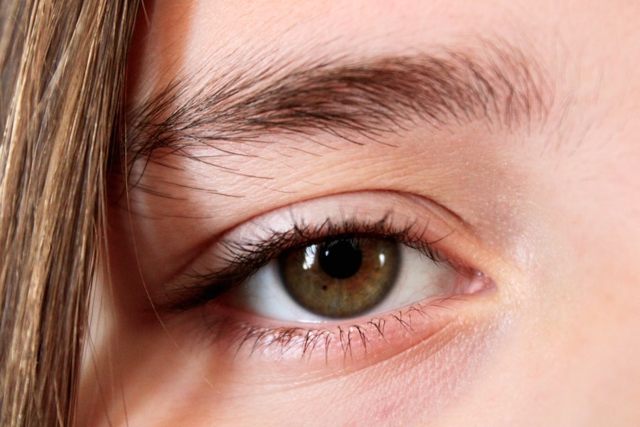 Photo Blepharoplasty