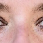 Discover the Benefits of Blepharoplasty in Poland