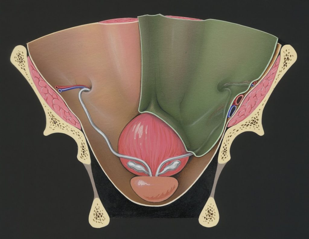 Photo Otoplasty