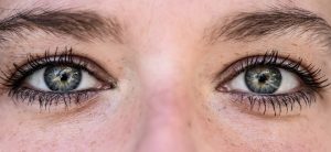 Photo Blepharoplasty