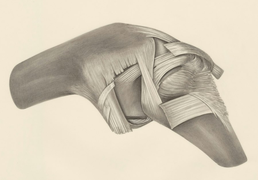 Photo ACL reconstruction